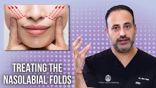 Treating the Nasolabial Folds | Lesson of the Day