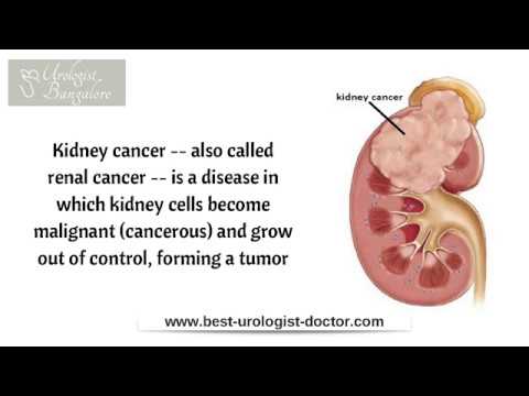 Kidney/Renal Transplantation