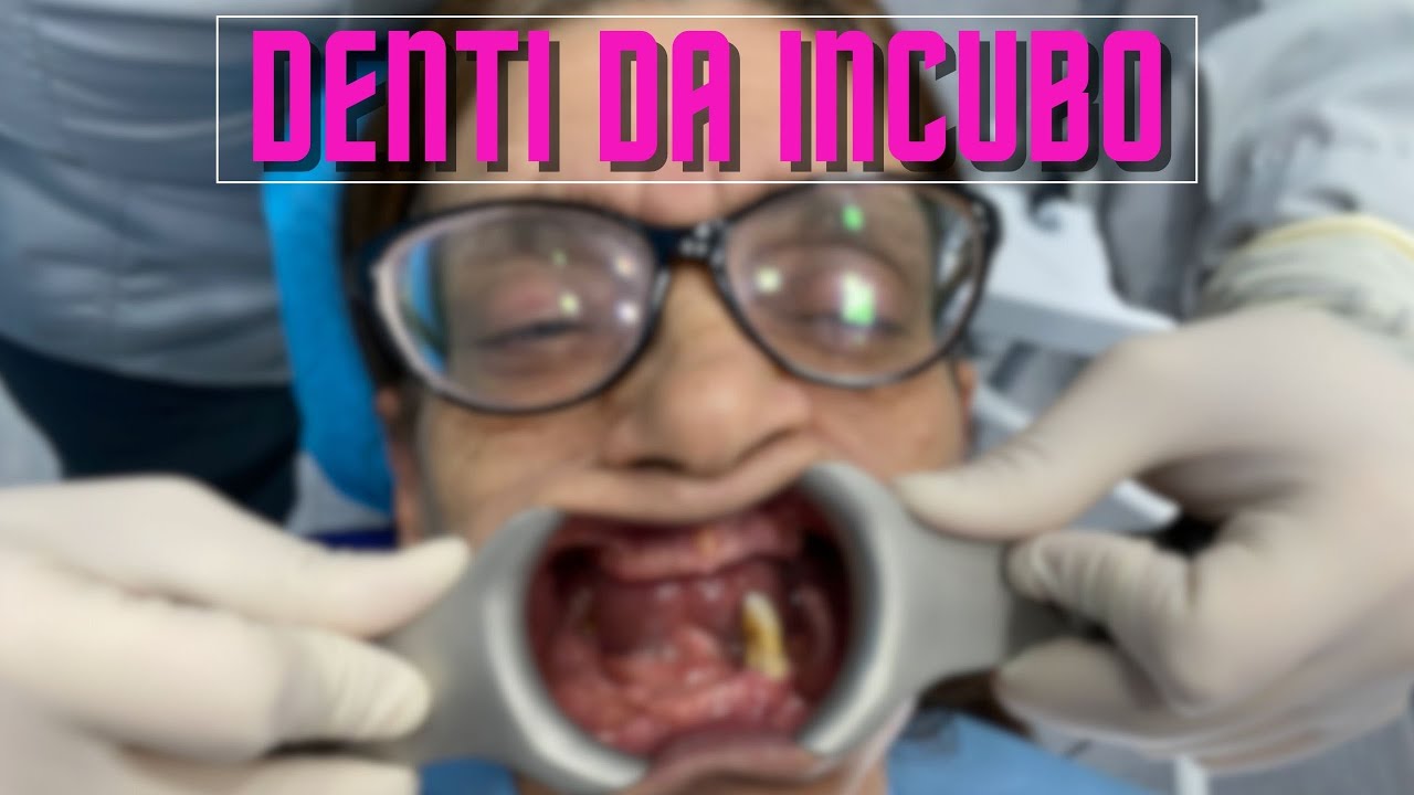 Denti da incubo [TRE CASI DISPERATI]