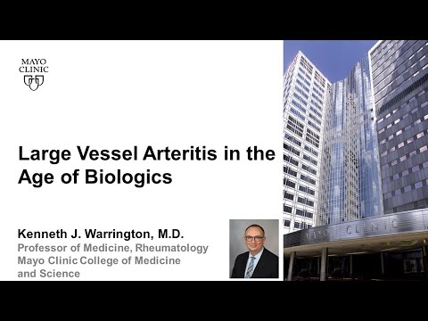 Large Vessel Arteritis in the Age of Biologics