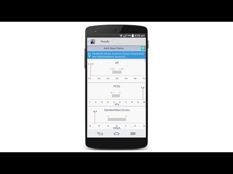 Acid-Base Calculator Video