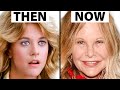 Meg Ryan S NEW FACE Plastic Surgery Analysis