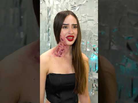 أنا جديدة في المدرسة! أشعر بالخجل من مرضي!