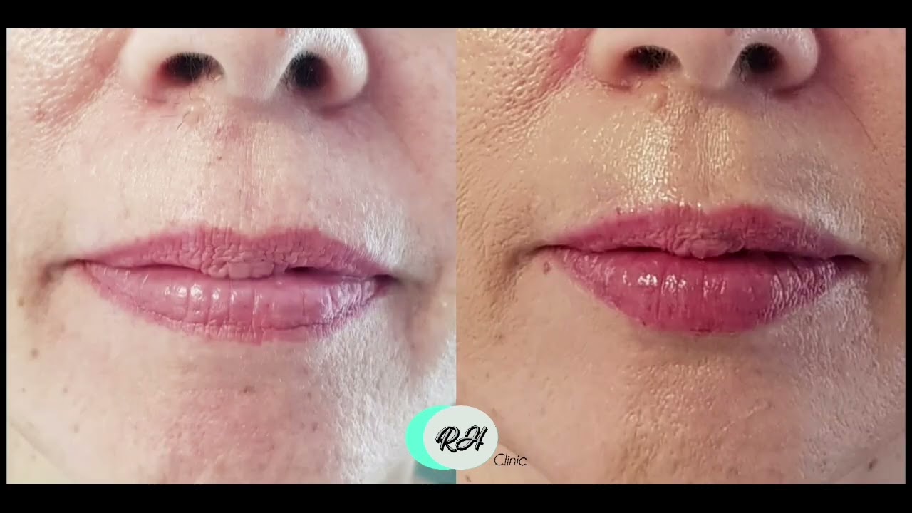 Rosalba Herrero Zerpa-632