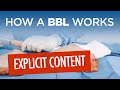 How A BBL Works