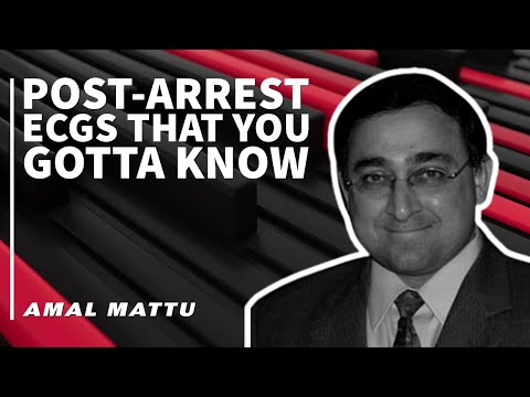 Post-Arrest ECGs That You Gotta Know