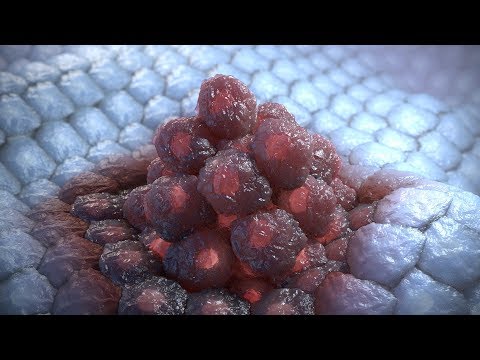 Random42 Science in Motion - Cancer Pathways