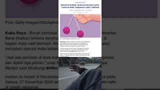 Download lagu Latto Latto makan Korban lagi mp3 Download lagu Latto Latto makan Korban lagi mp3