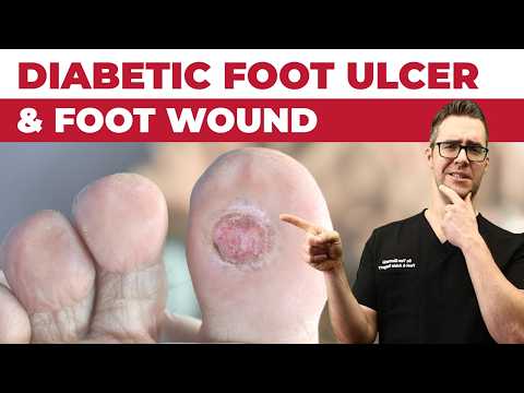 Bunion Home Treatment Top 7 Bunion Correctors Splints Gel Pads