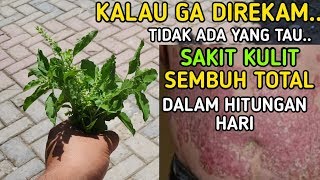Download lagu Banyak Yang Belum Tau,Daun Ini Ternyata Ampuh Sembuhkan Kulit Gatal,Eksim,Kudis dan Kurap mp3