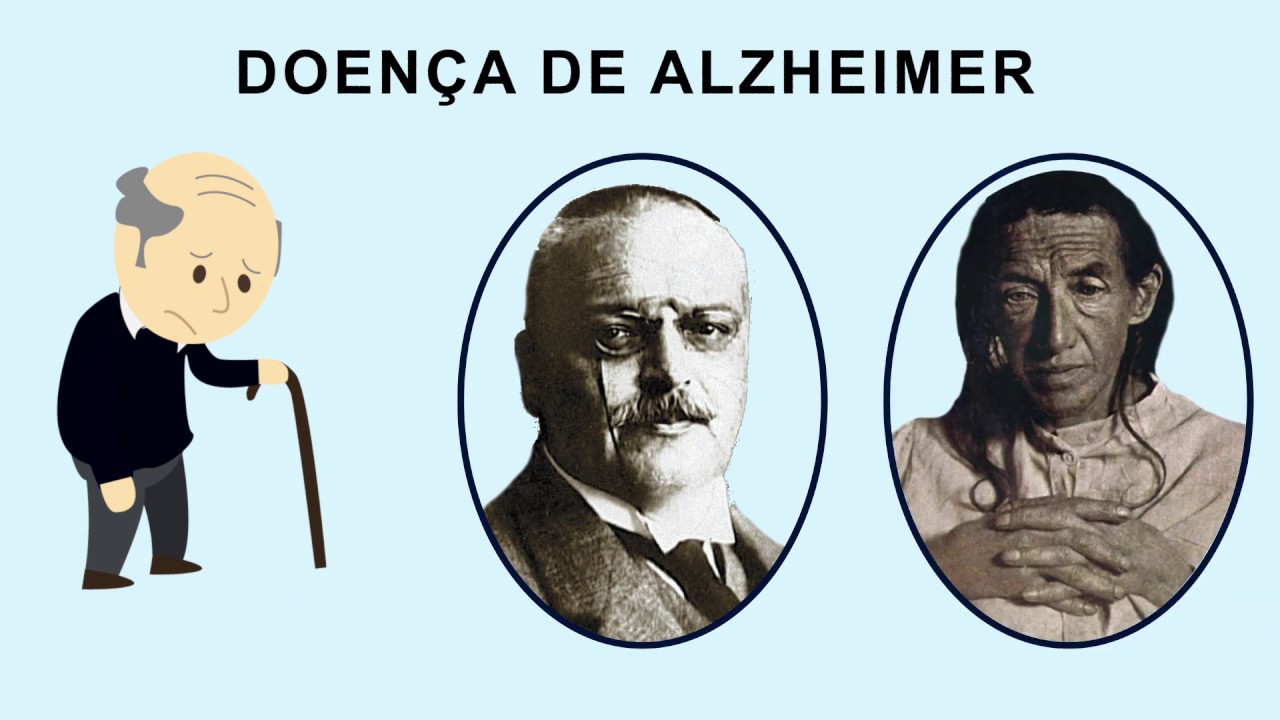 Farmacologia da Doença de Alzheimer | Inibidores da AchE & Antagonista NMDA