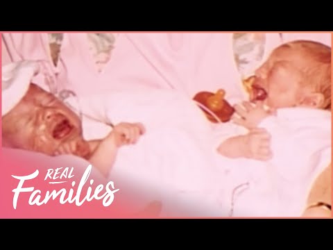 Real Families: Inspiring Journey of Miracle Conjoined Twins