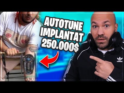 AUTOTUNE Implantat für 250.000$....WTF