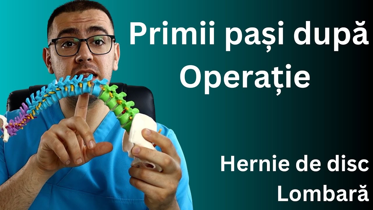 2. Kinetoterapie coloana vertebrală lombară hernie de disc lombară Home