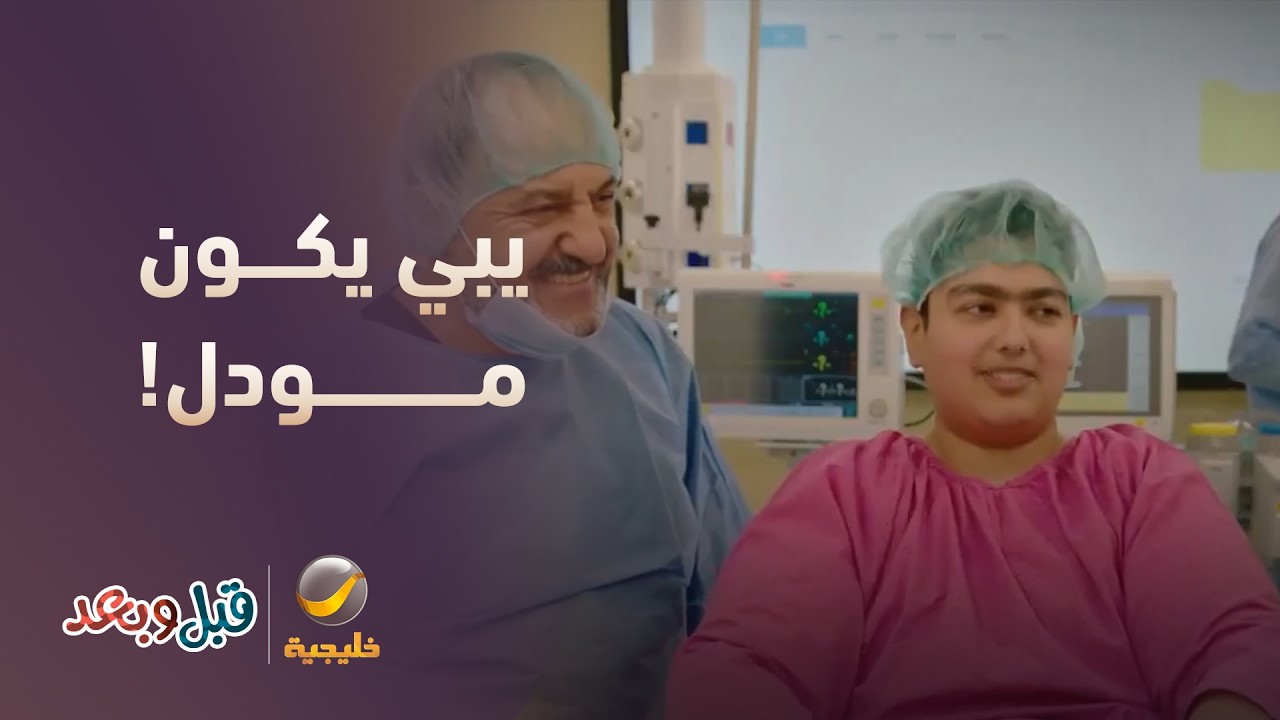 150 كيلو ويبي يكون مودل! - مسلسل قبل وبعد