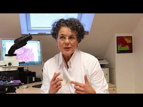 GesundSchau - Syphilis vorbeugen