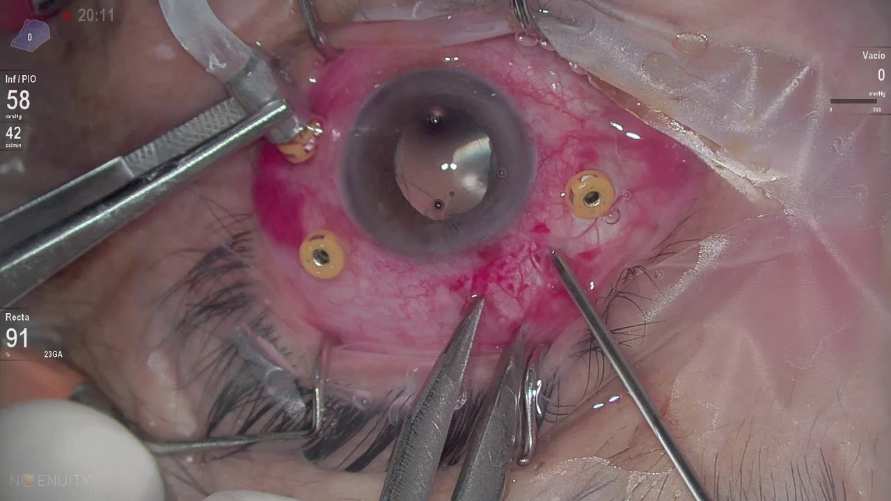 Marco Antonio Rayón Rodríguez-15