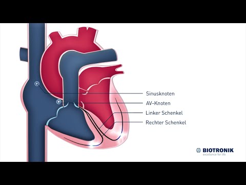Elektrische Reizleitung des Herzens (Animation Medizin)