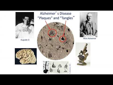 AANP Teaching Rounds - June 25, 2025 - Blood-Based Biomarkers for Alzheimer’s and Related Disorders