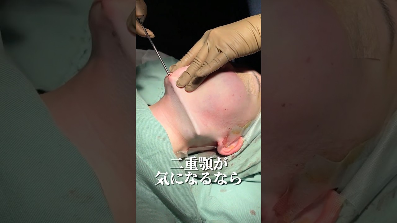 【二重顎が気になるなら】#shorts