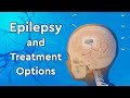 What is Epilepsy and How is it Treated?