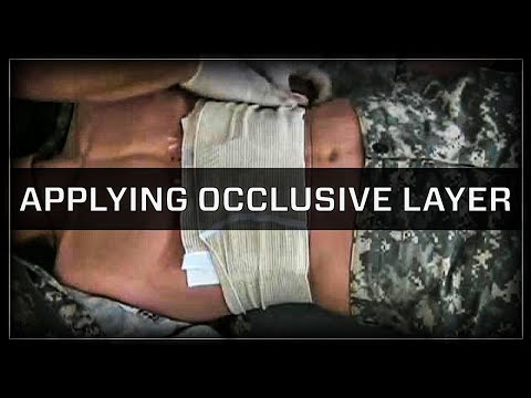 OLAES® Modular Bandage Series: Applying Occlusive Layer