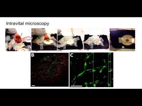 8th Annual TMII Symposium – 2018 – Session III – Nanomedicine – Alexandros Sofias, MSc