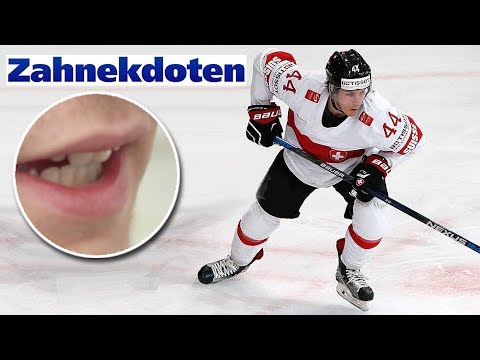 Suter: «Ich musste den Nerv mit einem Kaugummi abkleben»