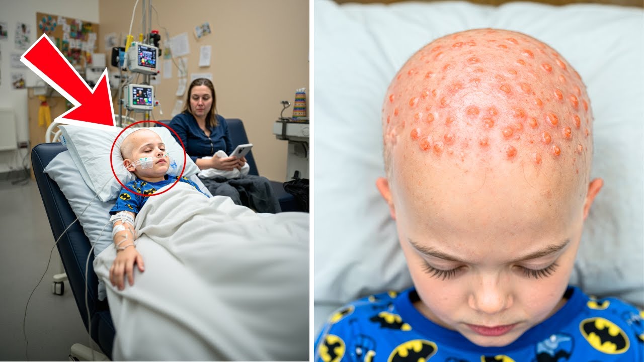 BALD in 1 Day What Happened to This Boy