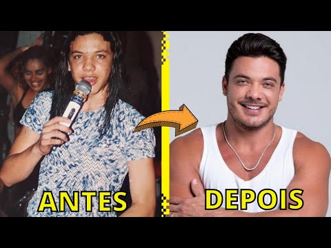 Famosos Antes e Depois da Fama