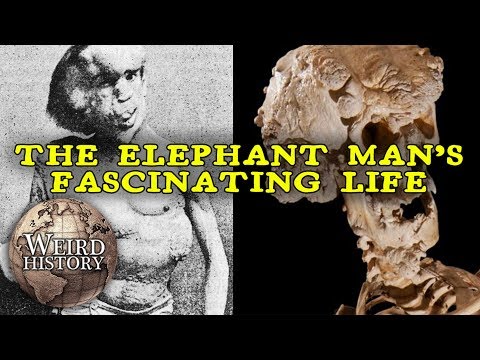 The Elephant Man | The Weird & Tragic Story of Joseph Merrick