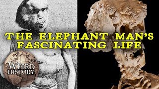 Elephant Man - The Weird &amp; Tragic History of Joseph Merrick