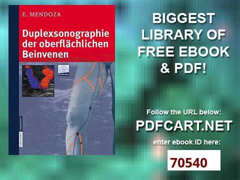 Duplexsonographie der oberflächlichen Beinvenen German Edition