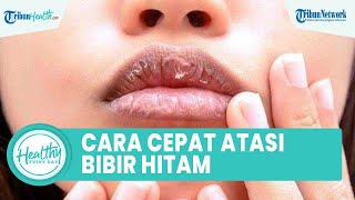 Cara Tepat Atasi Bibir Hitam, Satu di Antaranya Hindari Membasahi Bibir dengan Air Liur