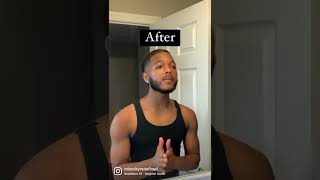 Download lagu 4 Months Minoxidil beard results #shorts mp3 Download lagu 4 Months Minoxidil beard results #shorts mp3