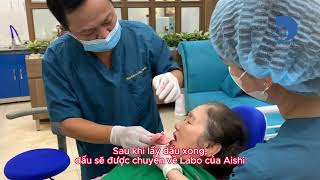Giới thiệu hàm tháo lắp phủ nano