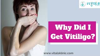 White Patches Treatment in Bangalore - VitalsKlinic