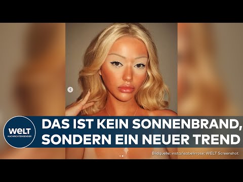 SONNENBRAND: "Sunburn Makeup" – Fragwürdiger Trend! Influencer schminken Wangen und Stirn knallrot