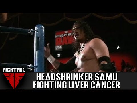 Samu Anoa’i Undergoes Successful Liver Transplant