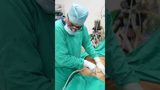 Download lagu Liposuction Surgery #abdomen #tummy #shorts #ytshort mp3