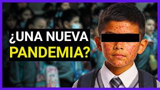CRISIS de SARAMPIÓN en MÉXICO: ¿Otro FRACASO de MORENA?