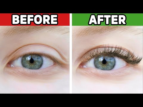 Shingles Natural Relief