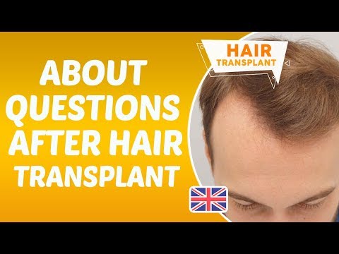 About Questions After Hair Transplantation - Dr. Hamid AYDIN