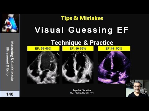 Visual Guessing Ejection Fraction- Technique & practice