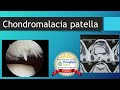 Chondromalacia Patella (All you want to know About)