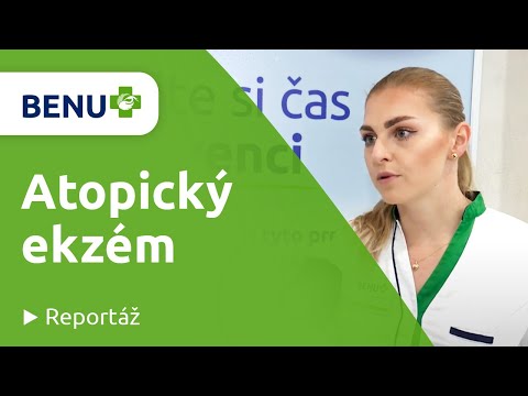 Atopický ekzém: Jak pečovat o pokožku?