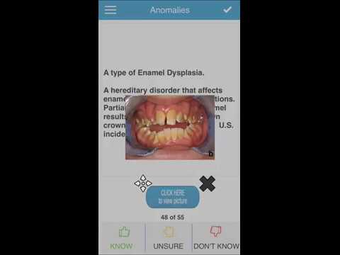 ADAT Periodontics Cram Cards