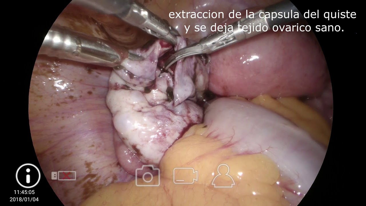 Jorge Alberto Rodriguez Pezino-63