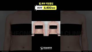 “팔·복부 라인 차이 생각보다 큼” 📏