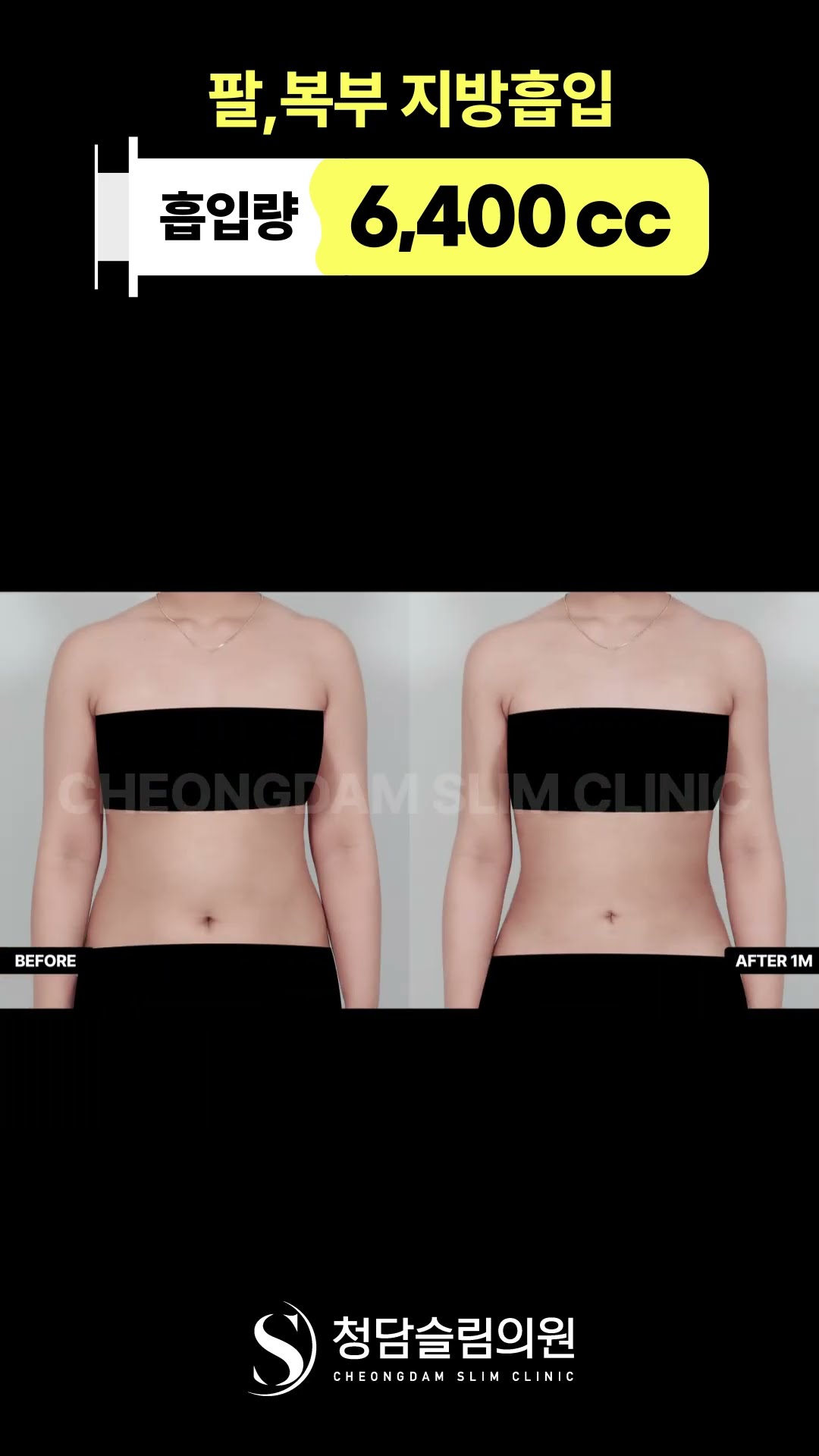 “팔·복부 라인 차이 생각보다 큼” 📏